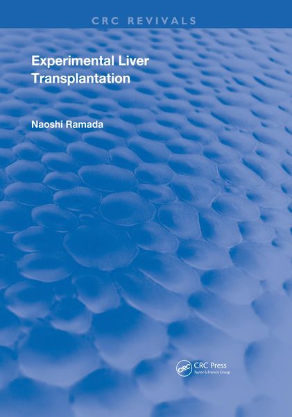 Produktbild: Experimental Liver Transplantation