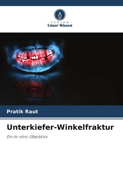 Unterkiefer-Winkelfraktur, Taschenbuch von Pratik Raut, Verlag Unser Wissen, 9786204615233