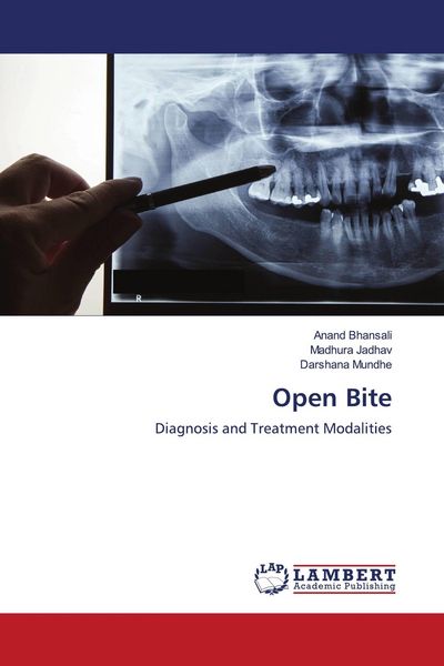 Produktbild: Open Bite
