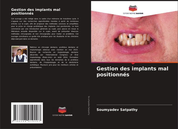 Produktbild: Gestion des implants mal positionn&eacute;s