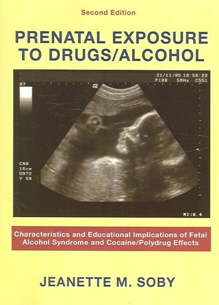 Produktbild: Prenatal Exposure to Drugs/ Alcohol: Characteristics and Educational Implications of Fetal Alcohol Syndrome and Cocaine/ Polydrug Effects