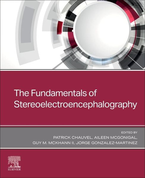 Produktbild: The Fundamentals of Stereoelectroencephalography