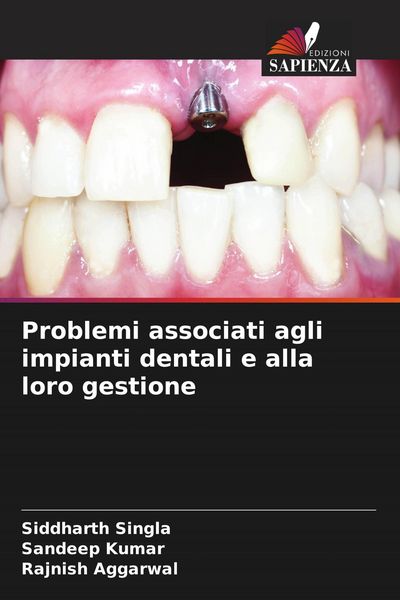 Produktbild: Problemi associati agli impianti dentali e alla loro gestione