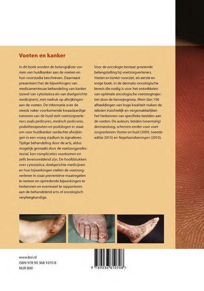 Produktbild: Voeten en kanker