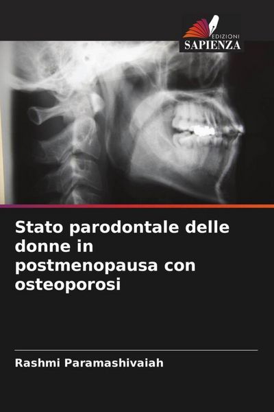 Produktbild: Stato parodontale delle donne in postmenopausa con osteoporosi