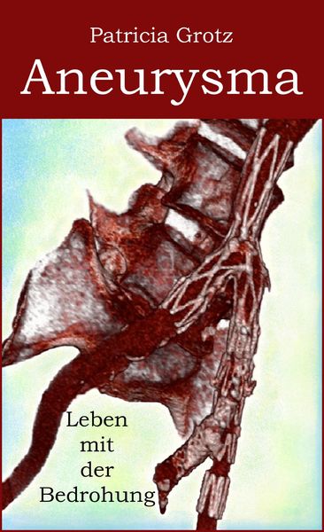 Produktbild: Aneurysma