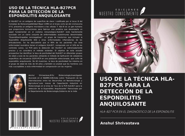 Produktbild: Uso De La T&eacute;cnica Hla-B27pcr Para La Detecci&oacute;n De La Espondilitis Anquilosante