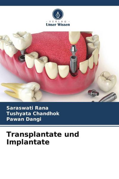 Produktbild: Transplantate und Implantate