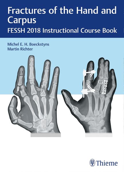 Produktbild: Fractures of the Hand and Carpus