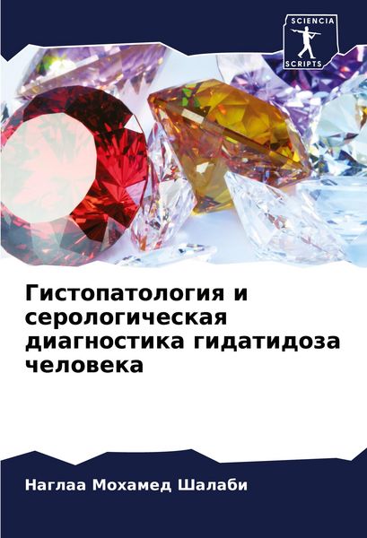 Produktbild: Gistopatologiq i serologicheskaq diagnostika gidatidoza cheloweka