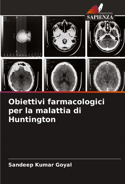 Produktbild: Obiettivi farmacologici per la malattia di Huntington