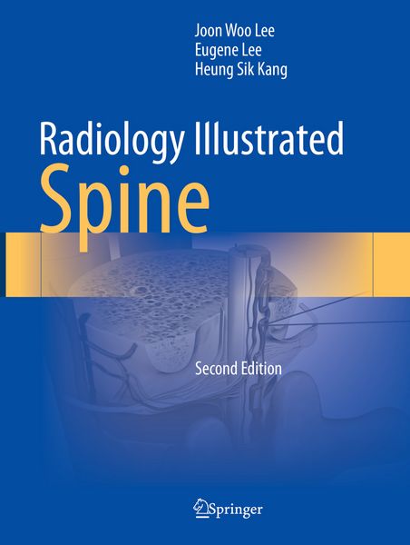 Produktbild: Radiology Illustrated: Spine