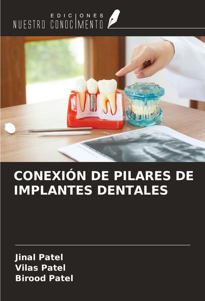 Produktbild: Conexi&oacute;n De Pilares De Implantes Dentales