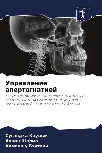 Produktbild: Uprawlenie apertognatiej