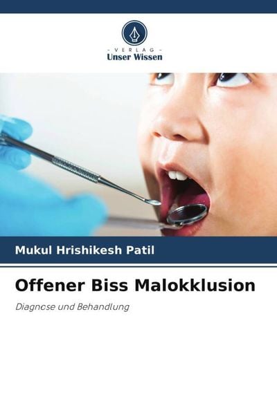 Offener Biss Malokklusion, Taschenbuch von Mukul Hrishikesh Patil, Verlag Unser Wissen, 9786206432890