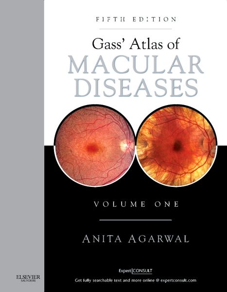 Produktbild: Agarwal, A: Gass' Atlas of Macular Diseases