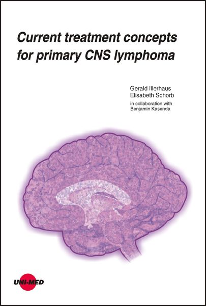 Produktbild: Current treatment concepts for primary CNS lymphoma