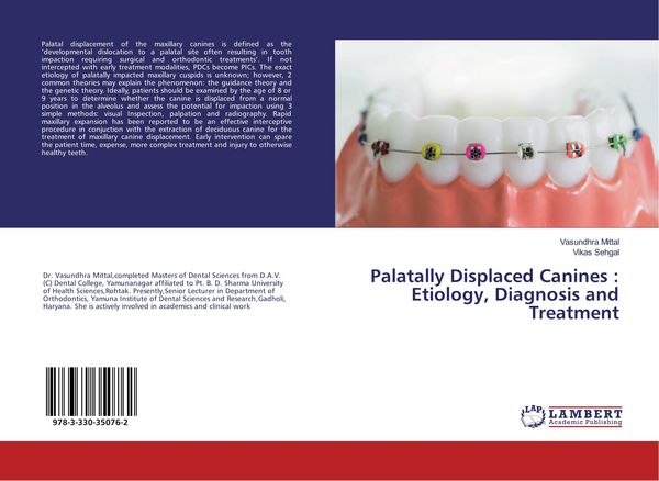 Produktbild: Palatally Displaced Canines : Etiology, Diagnosis and Treatment