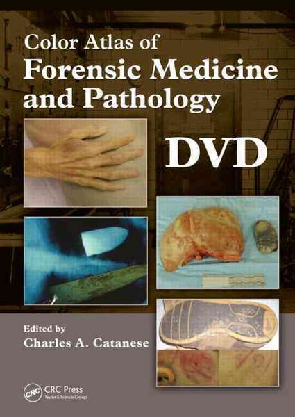Produktbild: Catanese, C: Color Atlas of Forensic Medicine and Pathology,
