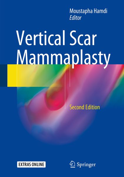 Produktbild: Vertical Scar Mammaplasty