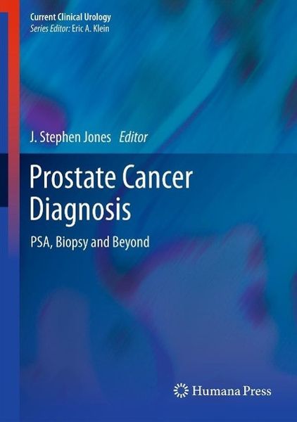 Produktbild: Prostate Cancer Diagnosis