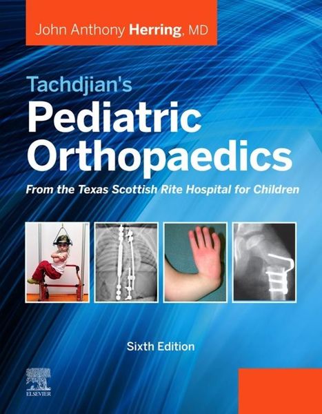 Produktbild: Tachdjian's Pediatric Orthopaedics: From the Texas Scottish Rite Hospital for Children E-Book