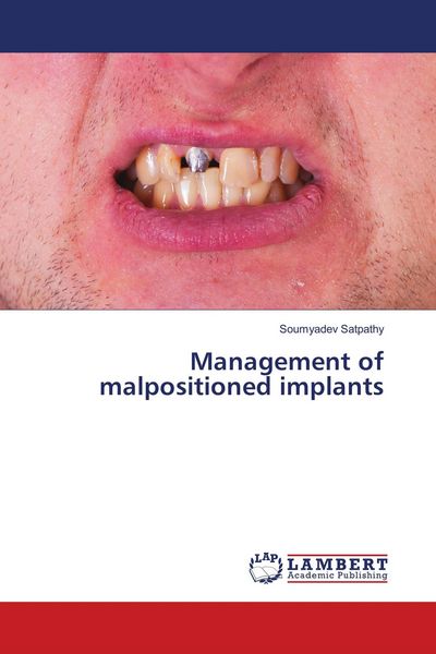 Produktbild: Management of malpositioned implants