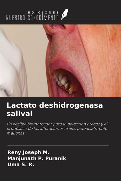 Produktbild: Lactato deshidrogenasa salival