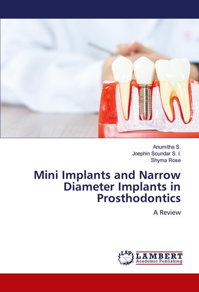 Produktbild: Mini Implants and Narrow Diameter Implants in Prosthodontics