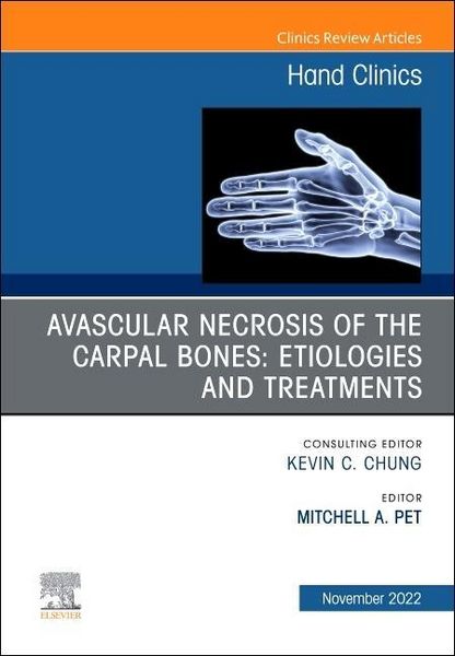 Produktbild: Avascular Necrosis of the Carpal Bones: Etiologies and Treatments, an Issue of Hand Clinics