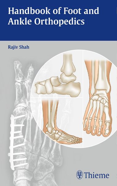 Produktbild: Handbook of Foot and Ankle Orthopedics