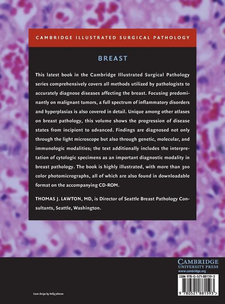 Produktbild: Illustrated Surgical Pathology of the Breast