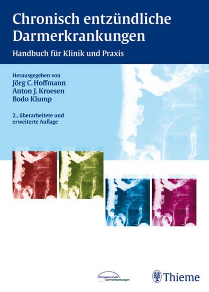 Produktbild: Chronisch entz&uuml;ndliche Darmerkrankungen