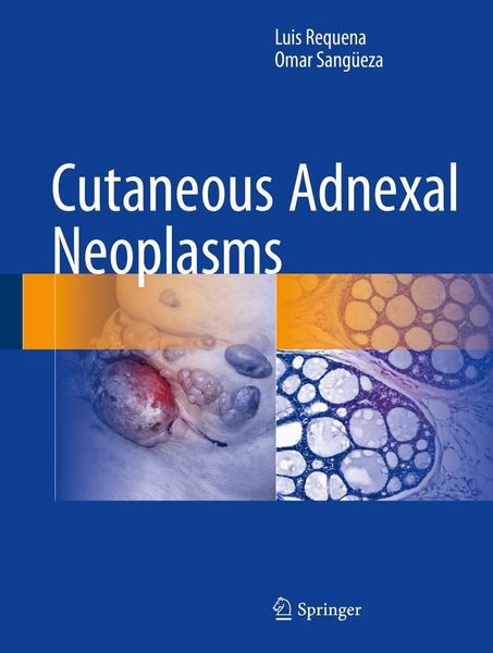 Produktbild: Cutaneous Adnexal Neoplasms