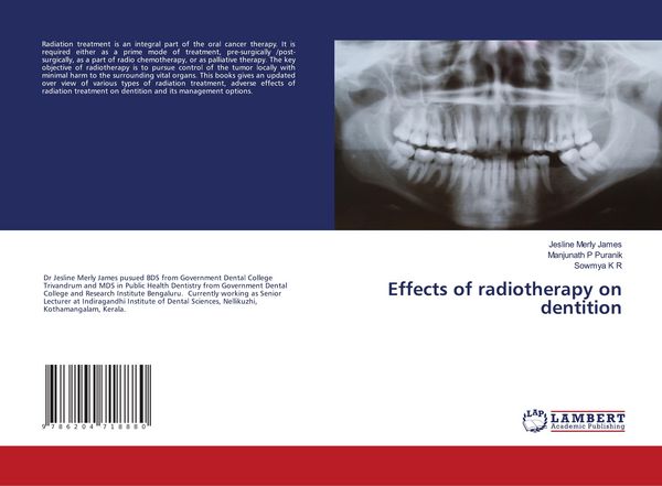 Produktbild: Effects of radiotherapy on dentition