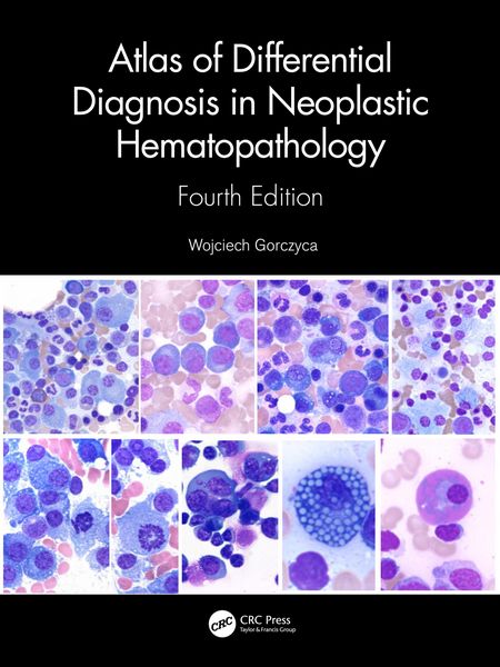 Produktbild: Atlas of Differential Diagnosis in Neoplastic Hematopathology