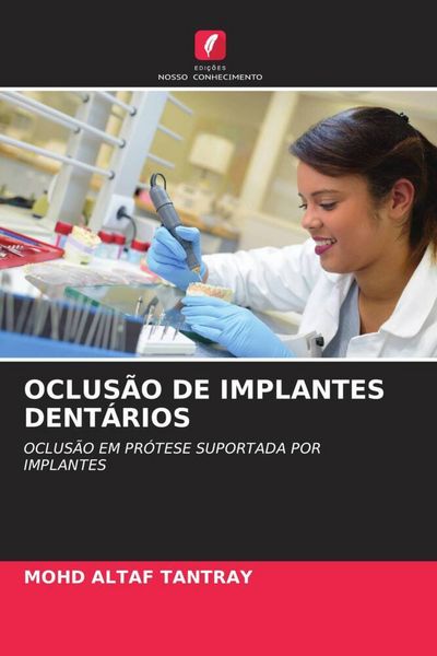 Produktbild: Oclus&atilde;o De Implantes Dent&aacute;rios