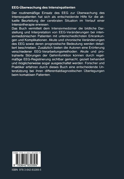 Produktbild: EEG-&Uuml;berwachung des Intensivpatienten