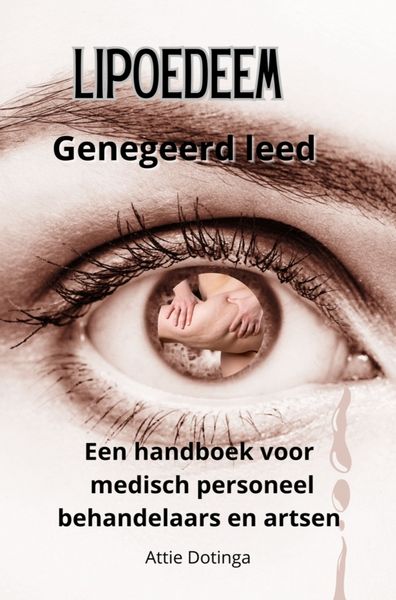 Produktbild: Lipoedeem