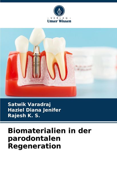 Biomaterialien in der parodontalen Regeneration, Taschenbuch von Satwik Varadraj , Haziel Diana Jenifer , Rajesh K. S., Verlag Unser Wissen,
