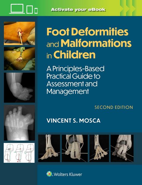 Produktbild: Foot Deformities and Malformations in Children