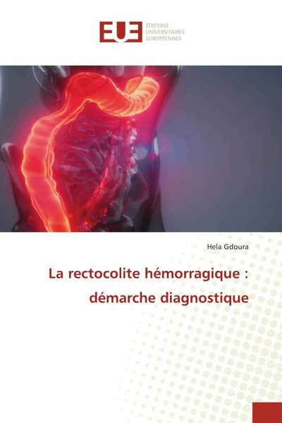 Produktbild: La rectocolite h&eacute;morragique : d&eacute;marche diagnostique