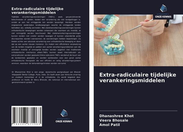 Produktbild: Extra-radiculaire tijdelijke verankeringsmiddelen