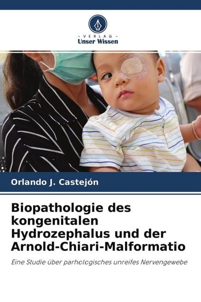 Biopathologie des kongenitalen Hydrozephalus und der Arnold-Chiari-Malformatio, Taschenbuch von Orlando J. Castejón, Verlag Unser Wissen,
