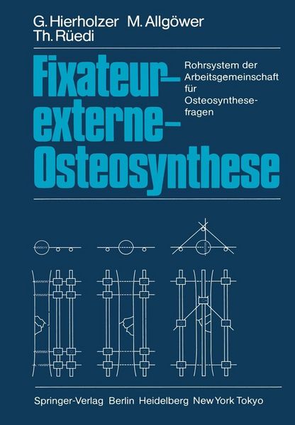 Produktbild: Fixateur-externe-Osteosynthese