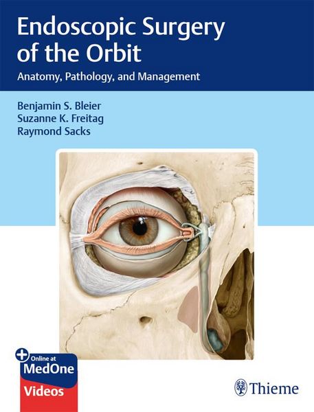 Produktbild: Endoscopic Surgery of the ORBIT