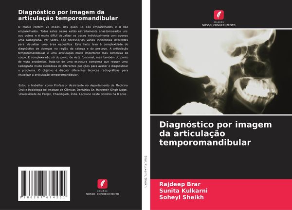 Produktbild: Diagn&oacute;stico por imagem da articula&ccedil;&atilde;o temporomandibular