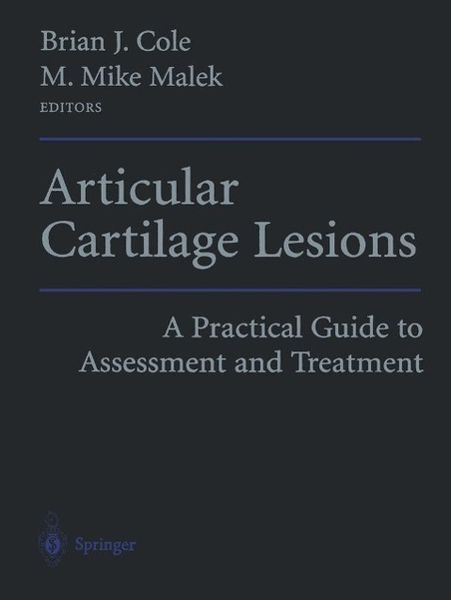 Produktbild: Articular Cartilage Lesions