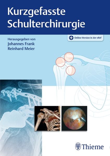 Produktbild: Kurzgefasste Schulterchirurgie