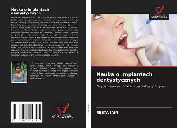 Produktbild: Nauka o implantach dentystycznych